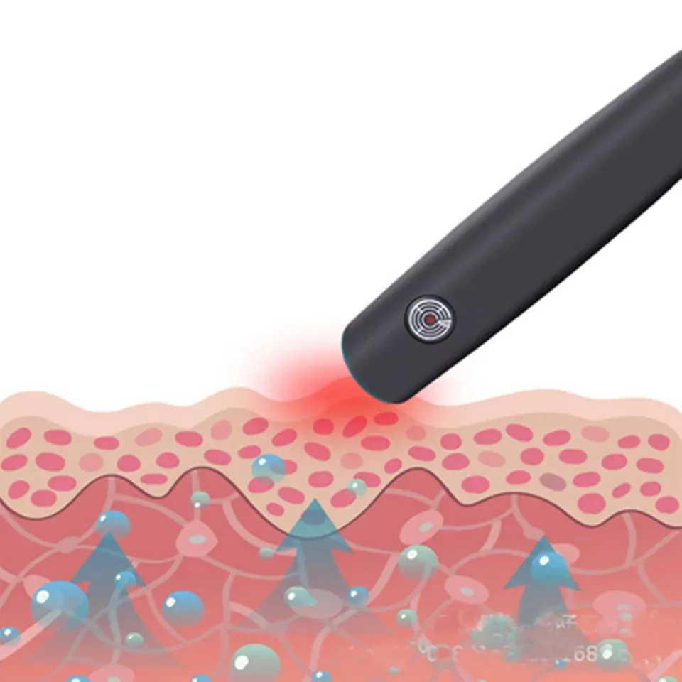 Mosquito Bite Helper